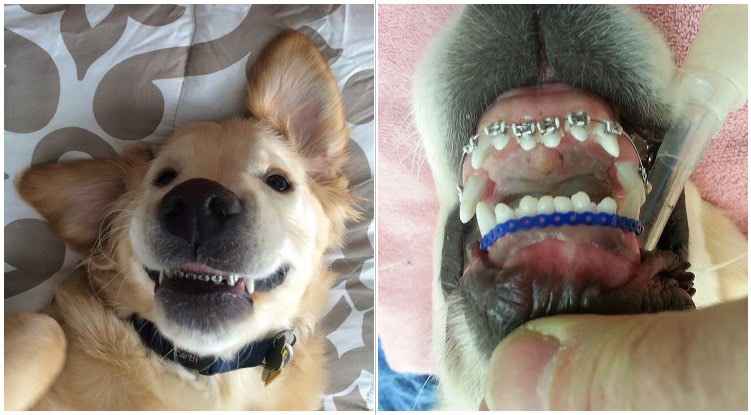 This Golden Retriever Couldn’t Close His Mouth, So He Got Braces