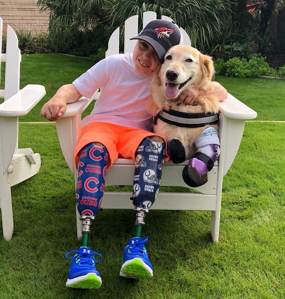 boy with amputee legs met a golden retriever with amputee legs